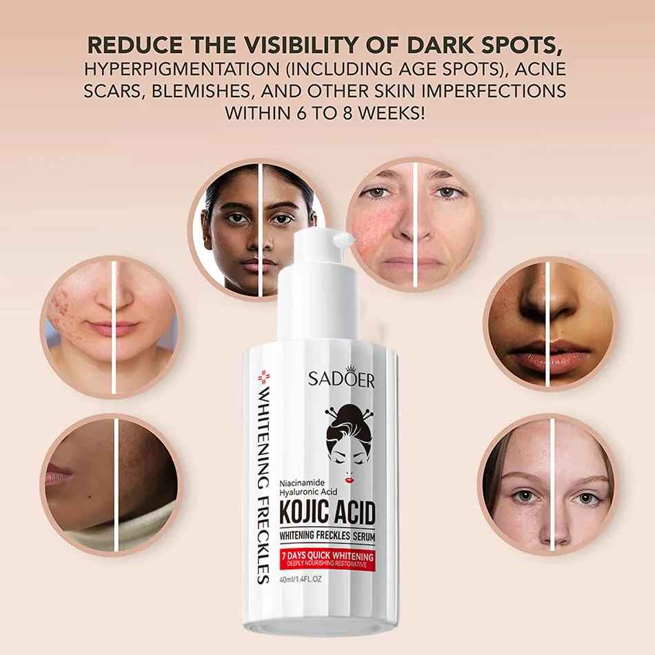 LOÇÃO KOJIC