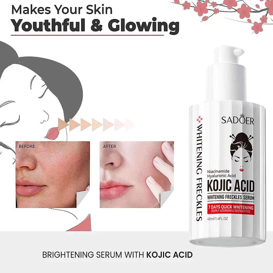LOÇÃO KOJIC