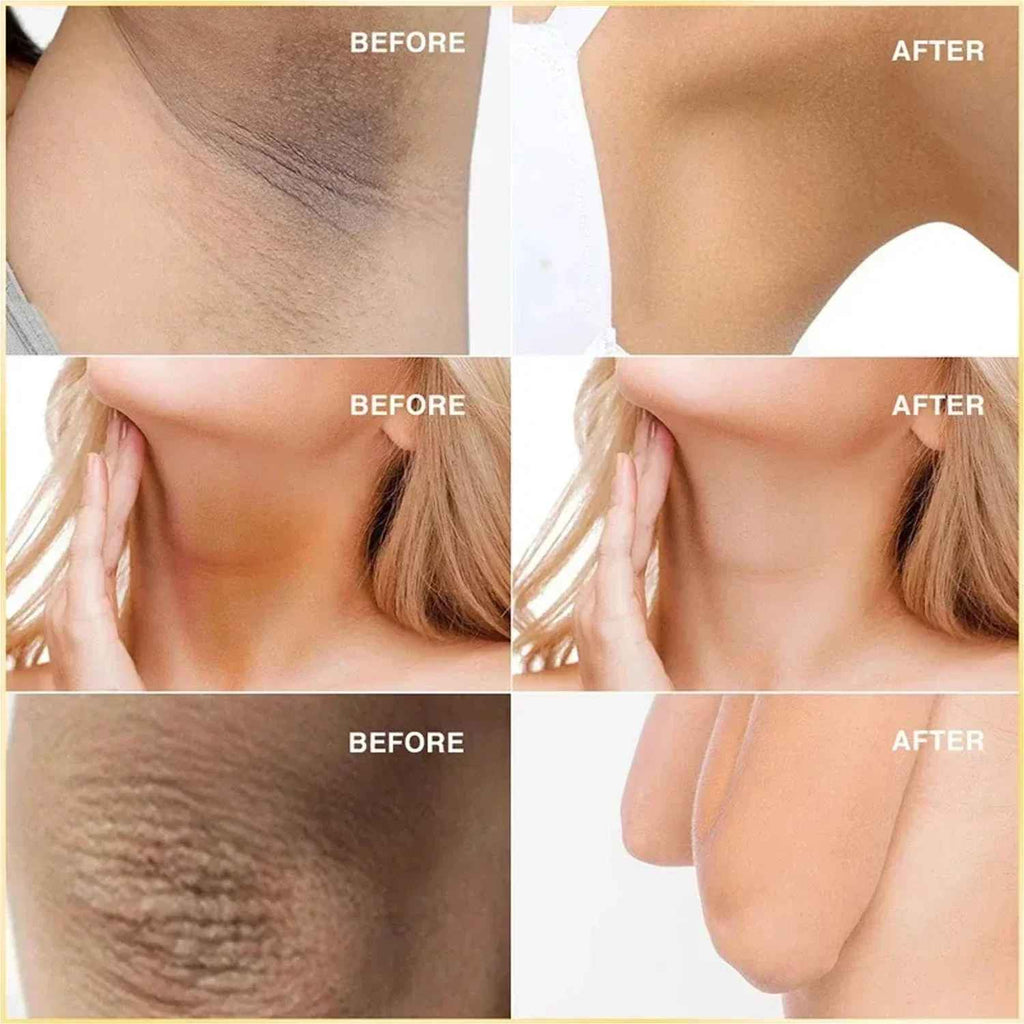 SABONETE KOJIC