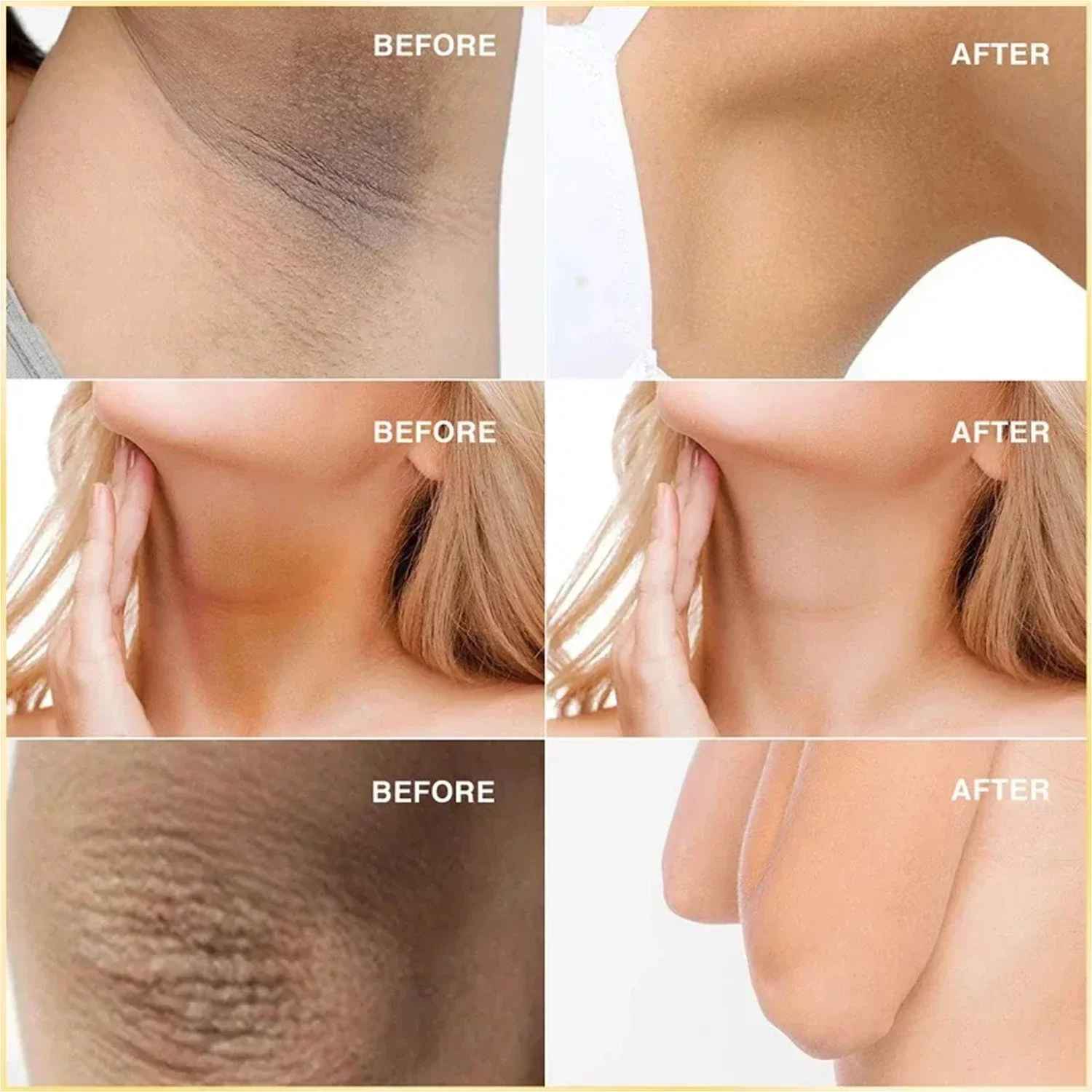 SABONETE KOJIC