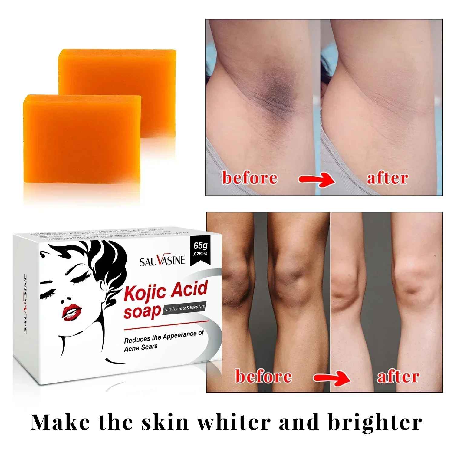 SABONETE KOJIC