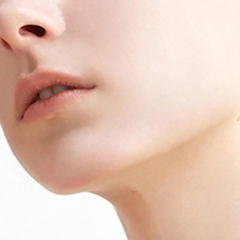 SABÃO ANTIACNE